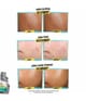 Produktbild 5 von 6, Kiehl's Truly Targeted Pickeltupfer