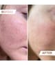 Produktbild 4 von 4, M1 SELECT NEEDLING Dermaroller