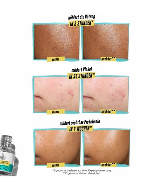 Produktbild 5 von 6, Kiehl's Truly Targeted Pickeltupfer