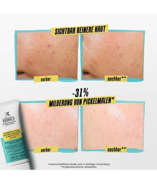 Produktbild 5 von 6, Kiehl's Expertly Clear Gesichtslotion