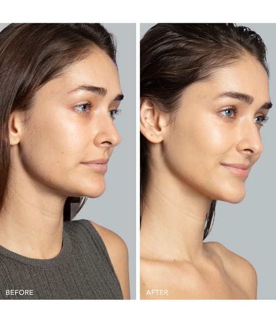 Produktbild 5 von 6, FOREO BEAR™ 2 Massagegerät