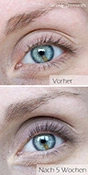 Vorher-Nachher Vergleich bei der Anwendung des RevitaLash Wimpernserum